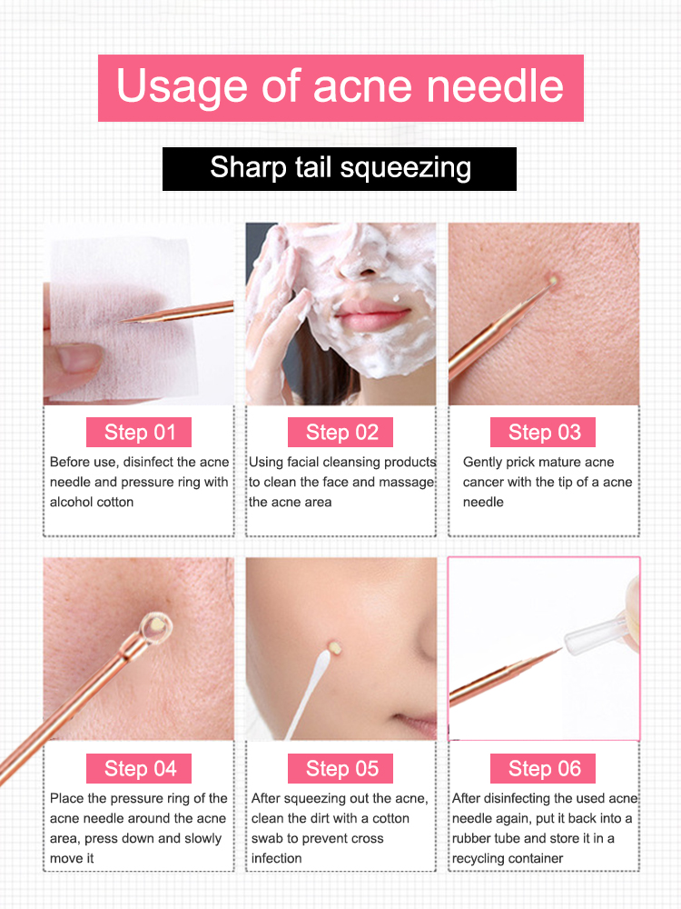 Siyah nokta Remover Sivilce Ko - Luxury Skincare Acne incelemesi ve fiyatı